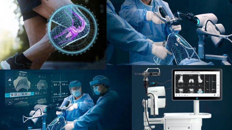 Evolutionizing Knee Surgery: How Robotic Assistance Enhances Knee Replacement Outcomes